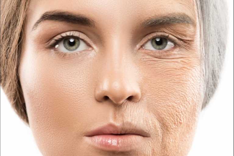 Фотостарение кожи: признаки и профилактика