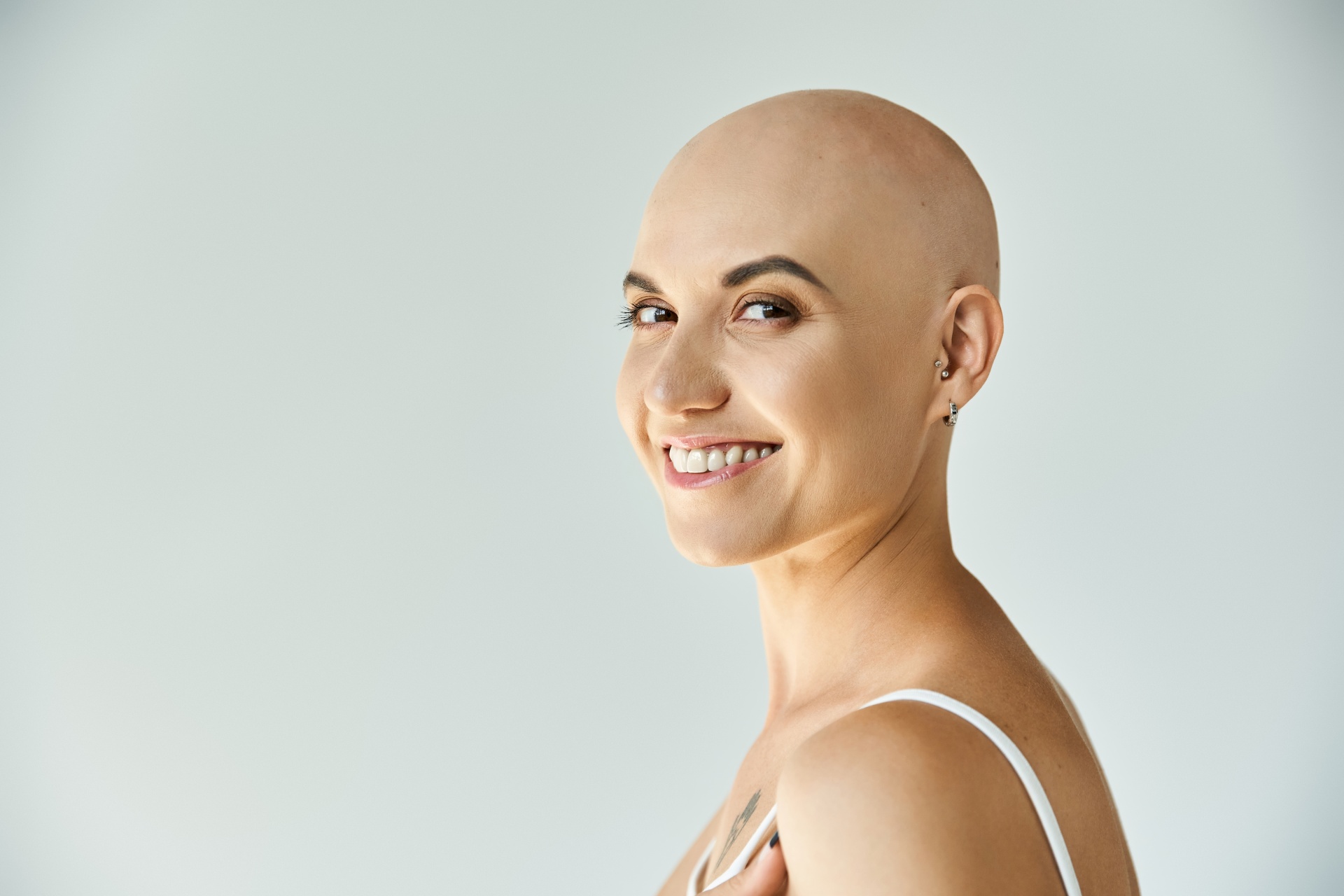 Алопеция (облысение)