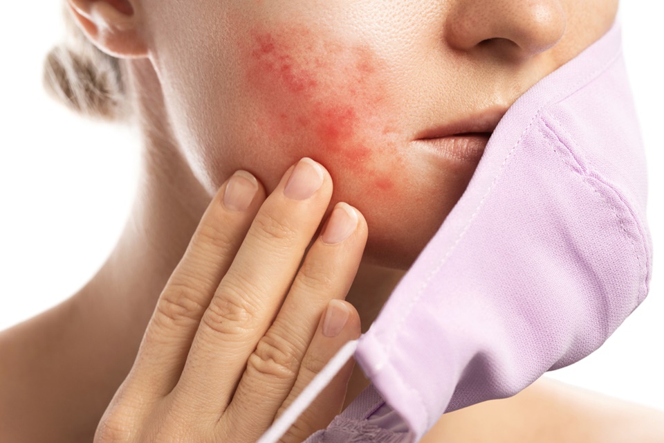 Аллергические высыпания на коже