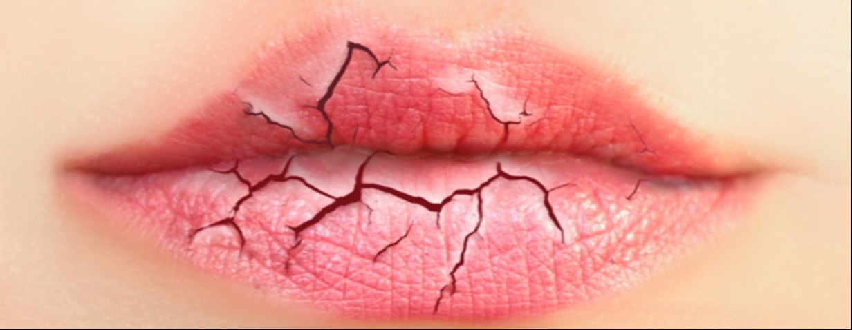 Почему сохнут губы у женщин, каких витаминов не хватает?