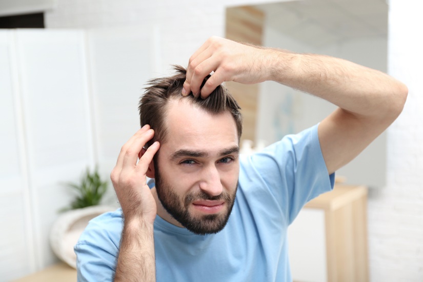 Причины выпадения волос у мужчин