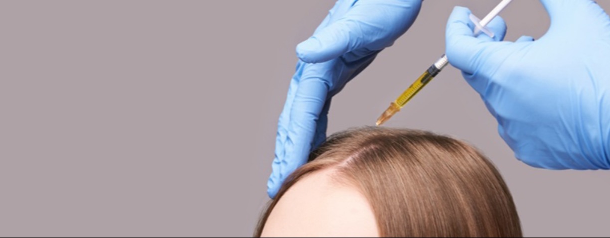 PRP-терапия кожных покровов волосистой части головы